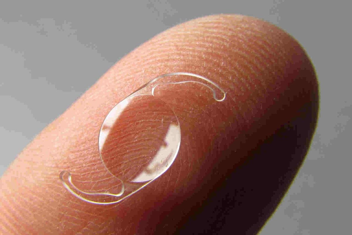 New IOL allows post-op fine-tuning