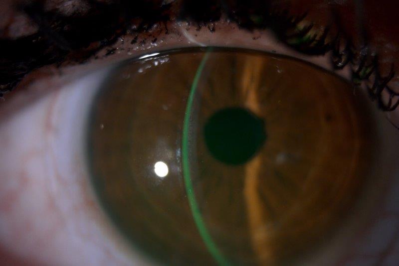 review of cornea and contact lens book review of cornea and contact lens book