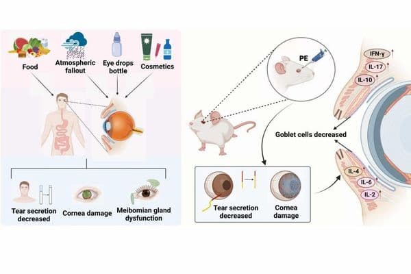 Dry eye research review 2025
