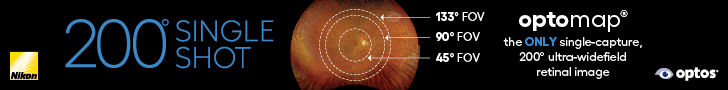 Optos Advertisement - Saving Sight