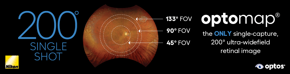 Optos Advertisement - Saving Sight