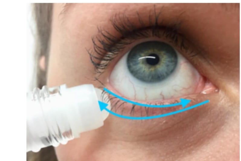 Castor oil for blepharitis