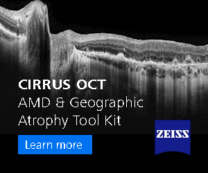Zeiss Cirrus Oct AMD advert