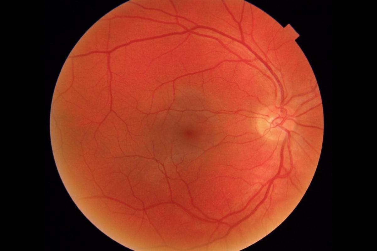 Moorfields spin-out dedicated to eyecare AI