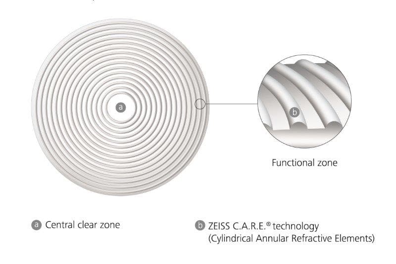 New age-tailored myopia management solution-zeiss_myocare_lightbox_artwork_au-03.jpg