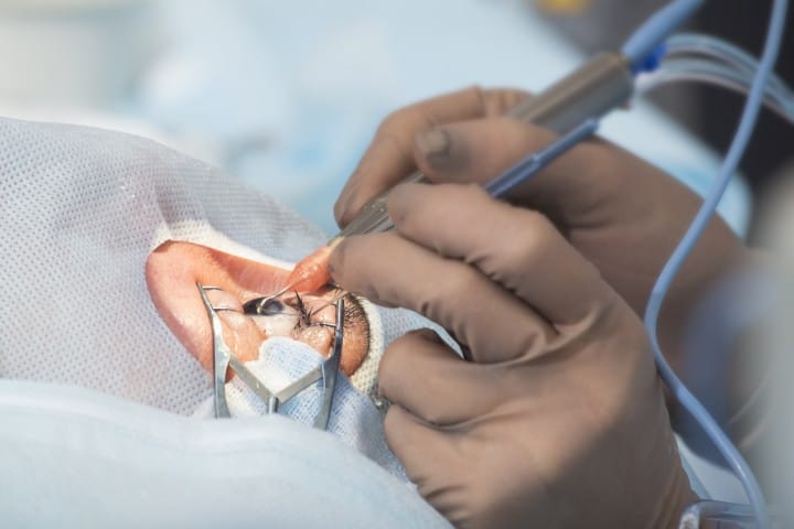 ISBCS shown to be safe and effective