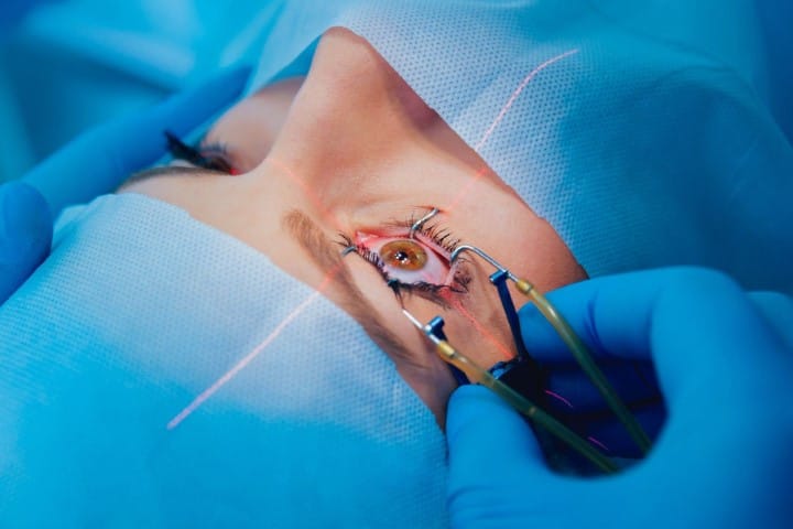 Dry eye and refractive surgery