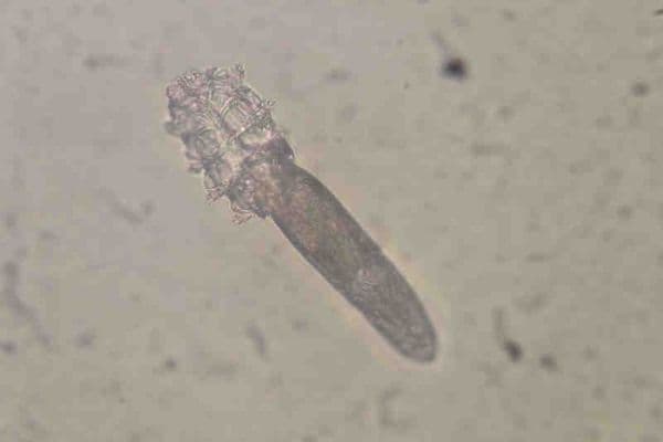 Demodex: the mighty mite or pesky parasite?