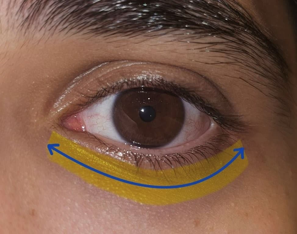 Fig 1A Periocular Image