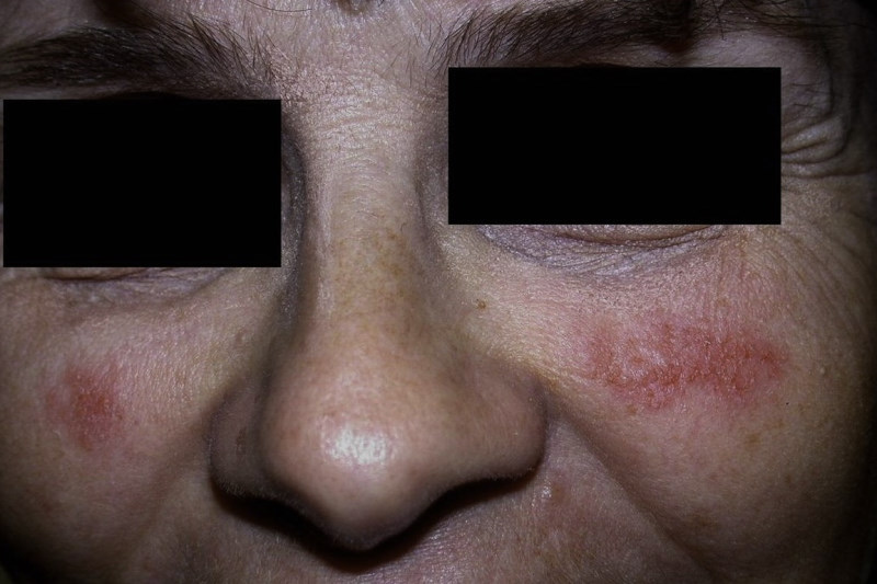 Allergic to glasses? eyeonoptics