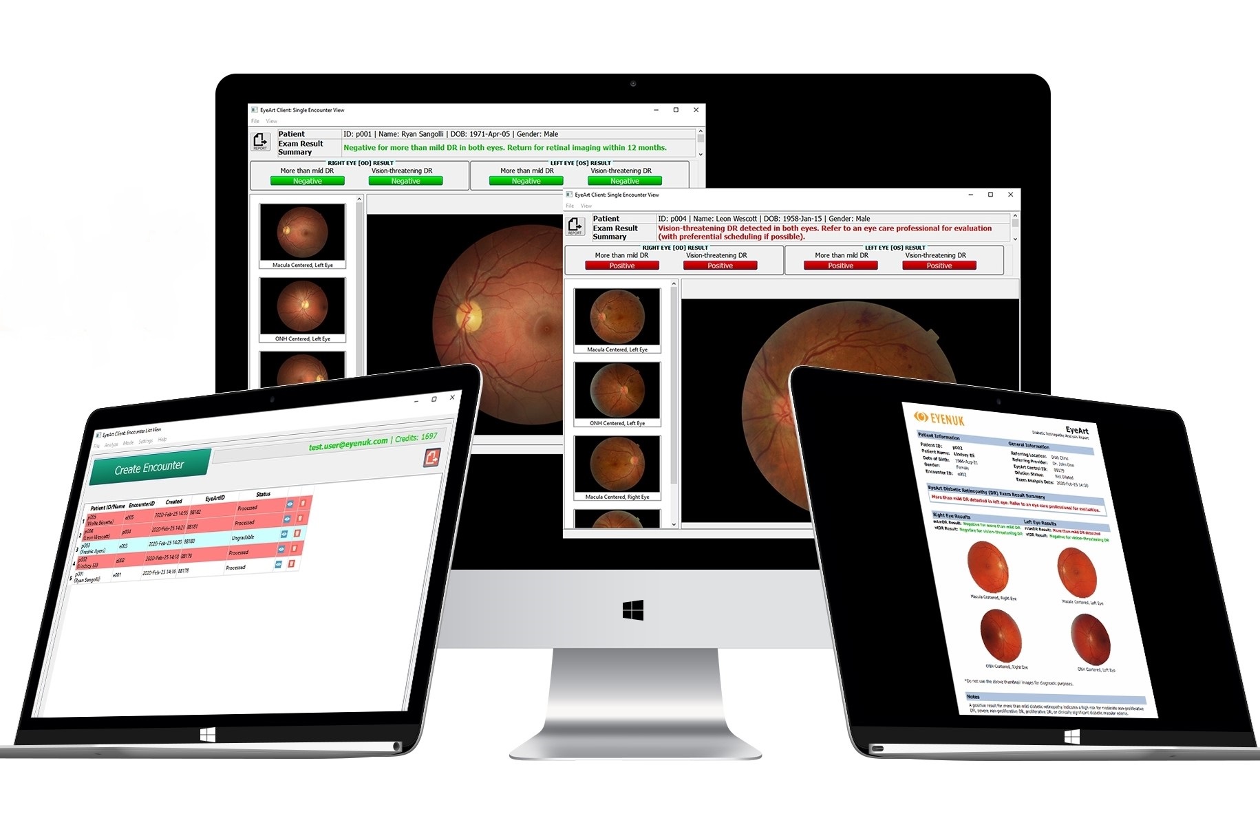Accessible AI system for DR screening eyeonoptics