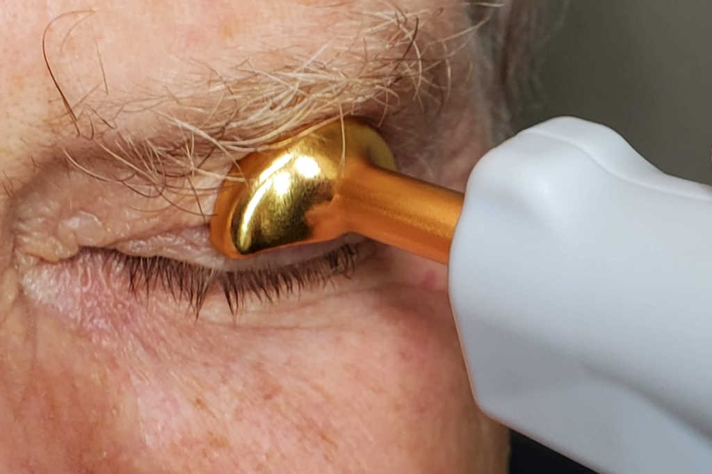 New dry eye management kit nzoptics