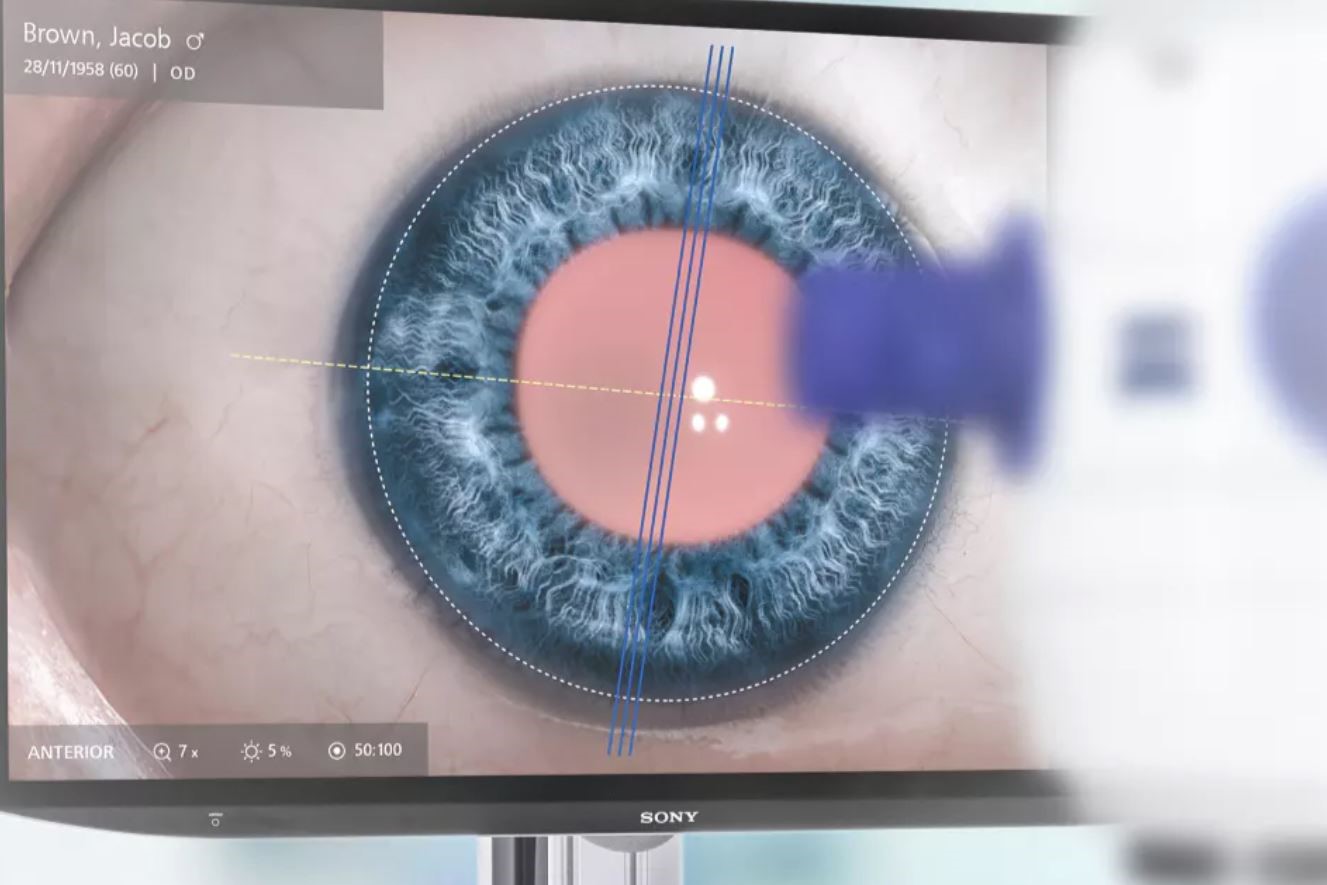 Zeiss unveils new ophthalmic devices